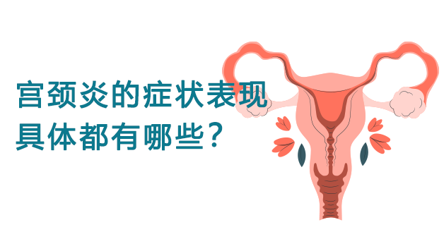 宫颈炎的症状表现具体都有哪些？