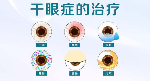 干眼症的症状有哪些？