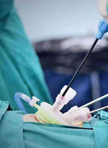 阴氏系列:宫、腹腔镜特色微创手术