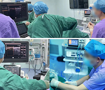 甲状腺结节射频消融治疗术