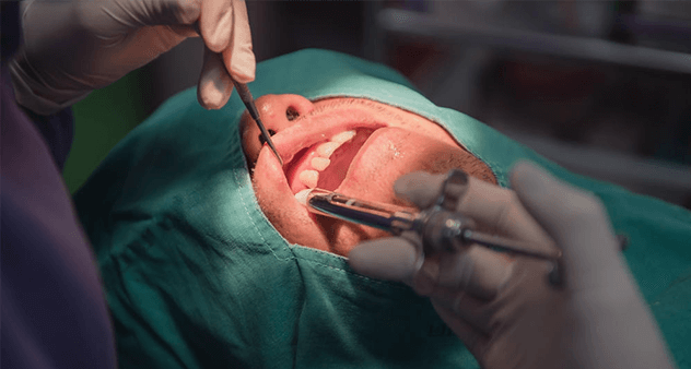 全麻后脑子会变傻吗？