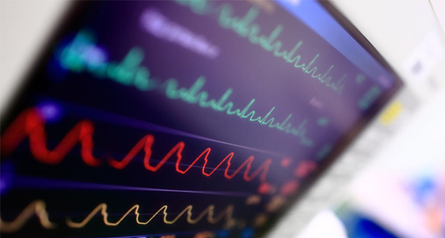 正常心电图的数值范围