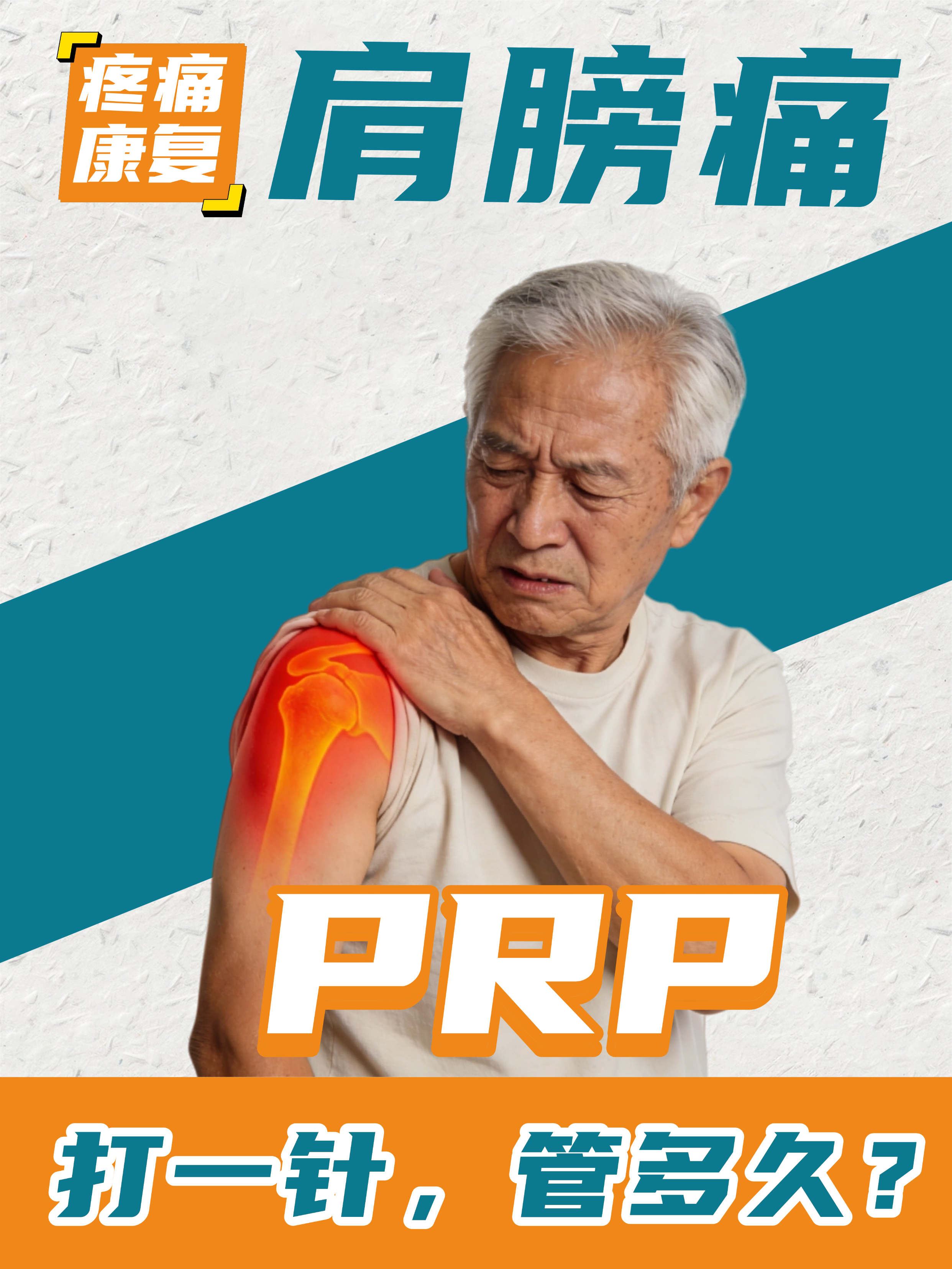 打一针PRP，『肩膀痛』能轻松多久？医生