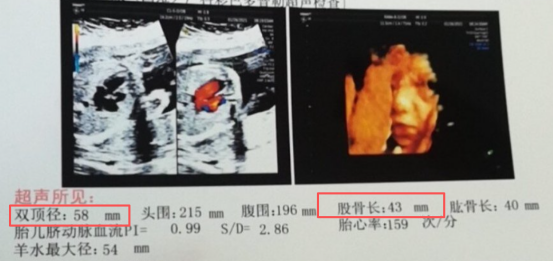 四维报告，这几个地方暗示胎儿性别？